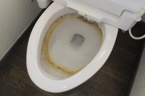 トイレ 尿石清掃前